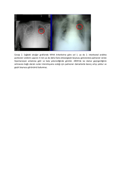 Cevap 2. Sağdaki akciğer grafisinde NYHA kriterlerine göre sol 1. ya