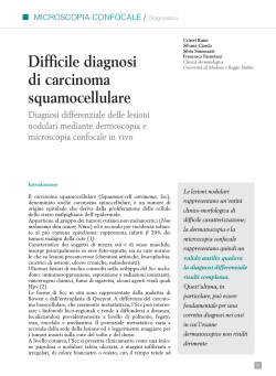 Difficile diagnosi di carcinoma squamocellulare