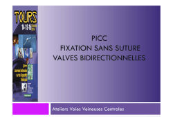 Picc valves bidirectionnelles - Euro
