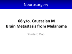 Brain Metastasis from Melanoma