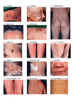 4-6 老人性紫斑 1-52 脂漏性皮膚炎 16-1 脂漏性角化症 15