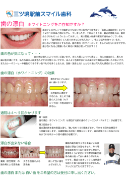 歯の漂白 ホワイトニングをご存知ですか？