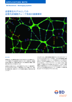 血管新生モデルとしての 血管内皮細胞チューブ形成の画像解析