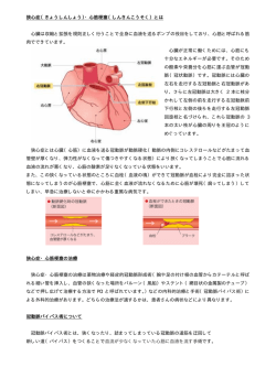 狭心症（きょうしんしょう）・心筋梗塞（しんきんこうそく）とは 心臓は収縮と