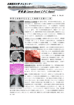 特異な画像所見を呈した胸膜中皮腫の1例