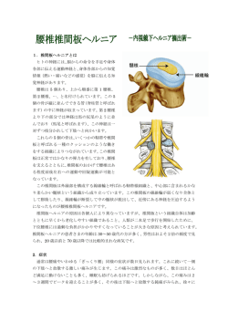腰椎椎間板ヘルニア（内視鏡下ヘルニア摘出術）