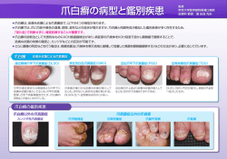 爪白癬の病型と鑑別疾患