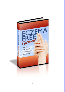 Rachel Anderson Eczema Free Forever PDF EBook