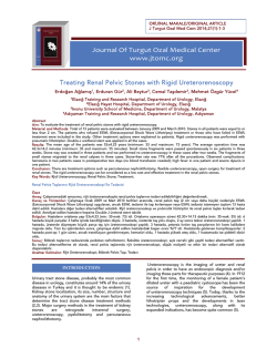 Treating Renal Pelvic Stones with Rigid Ureterorenoscopy