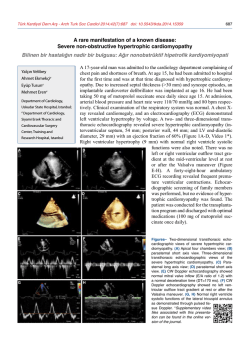 Severe non-obstructive hypertrophic cardiomyopathy