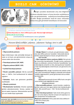 BUZLU CAM G&Ouml;R&Uuml;N&Uuml;M&Uuml;