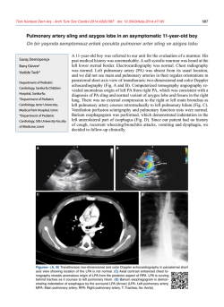 Pulmonary artery sling and azygos lobe in an asymptomatic 11-year