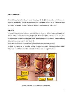 PROSTAT KANSERİ KONUSUNDA BİLMEK İSTEYECEKLERİNİZ