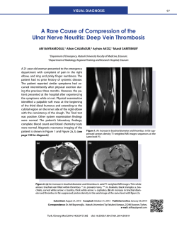 A Rare Cause of Compression of the Ulnar Nerve