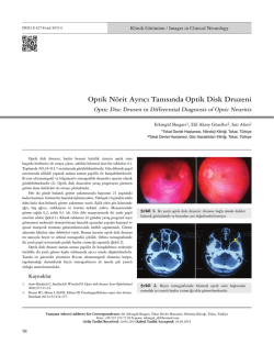 Optik N&ouml;rit Ayrıcı Tanısında Optik Disk Druzeni