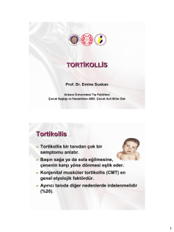 Acilde kazanılmış tortikolis