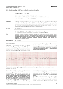 ECG of a Guinea Pig with Ventricular Premature Complex