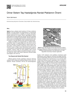 &Uuml;riner Sistem Taş Hastalığında Randal Plaklarının &Ouml;nemi