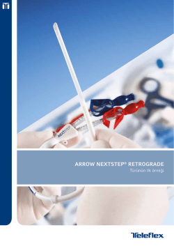 ARROW NEXTSTEP&reg; RETROGRADE