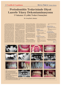 Periodontitis Tedavisinde Diyot Lazerle Y&uuml;zey Dekontaminasyonu
