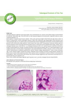 Subungual Exotosis of the Toe - Journal of Clinical and Analytical