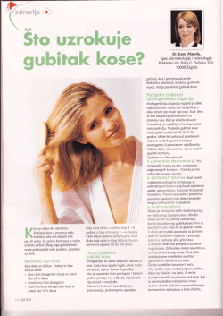 &Scaron;to uzrokuje gubitak kose