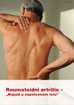 Reumatoidni artritis –