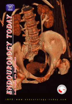 Untitled - Endourology Today