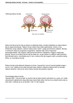 Definicija diskus hernije - Kiromax