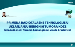 Primena radiotalasne tehnologije u uklanjanju benignih tumora kože