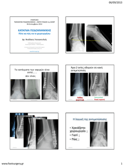 Κατάγματα ποδοκνημικής. Πότε και πώς να τα χειρουργήσω