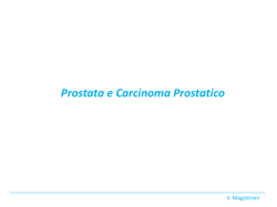 Carcinoma prostatico