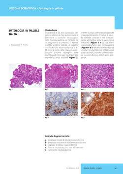 Tumore neuroendocrino ben differenziato