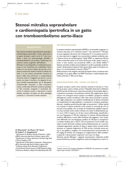 Stenosi mitralica sopravalvolare e cardiomiopatia