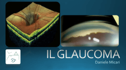 IL GLAUCOMA - LUTE Milazzo