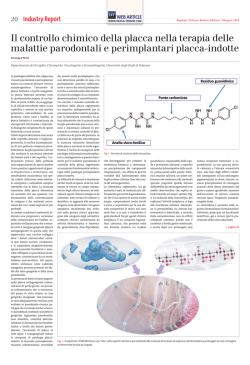 Il controllo chimico della placca nella terapia delle malattie