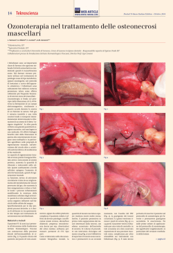 14-15 Ozonoterapia nel trattamento delle osteonecrosi mascellari