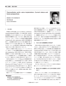 Transcatheter aortic valve implantation. Current