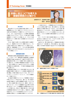 診断に役立つCTを考える ―画像診断医の立場から