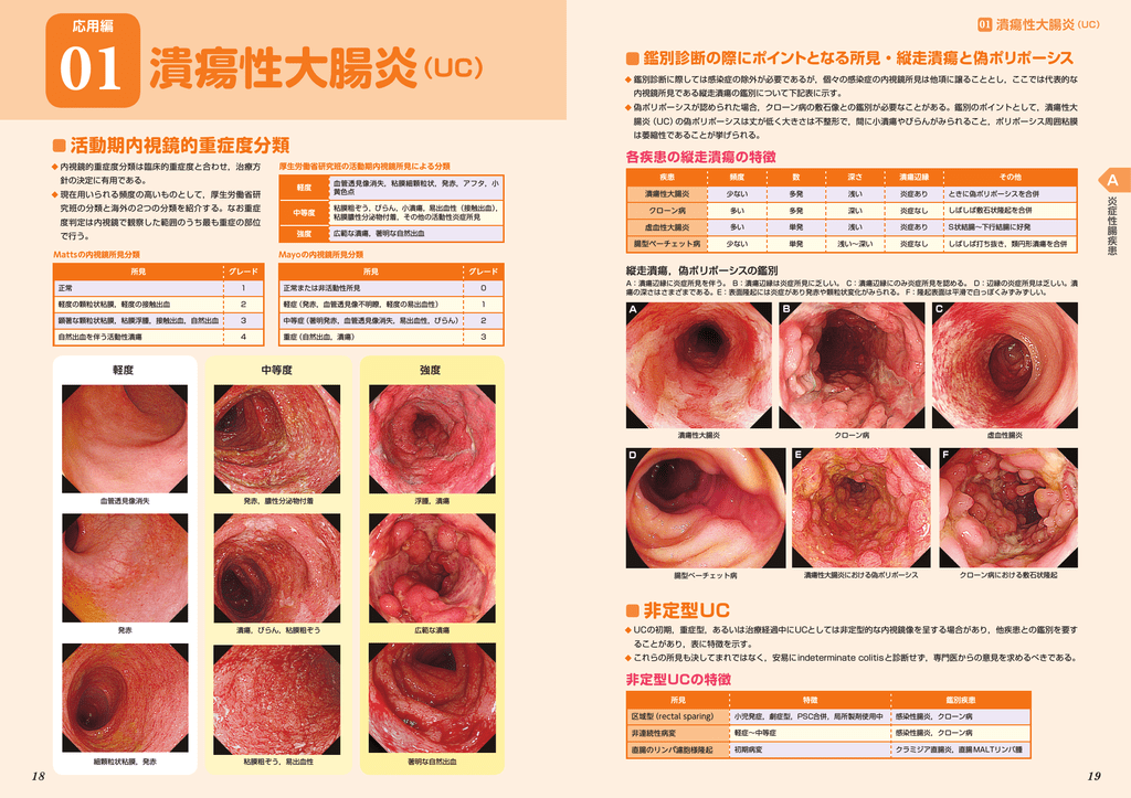 炎症性腸疾患の主な症状と診断 ｉｂｄの検査 内視鏡 ｅｒｉｇ 高野病院