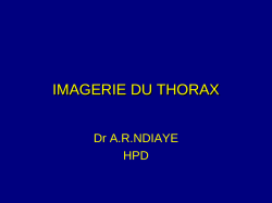 6 imagerie du thorax 2