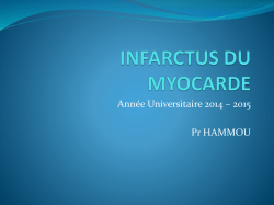 infarctus du myocarde
