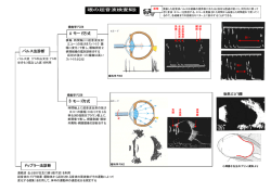 超音波検査解説 - 視能訓練士 眼科検査マニュアル