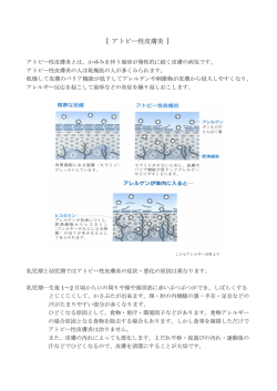 アトピー性皮膚炎の説明