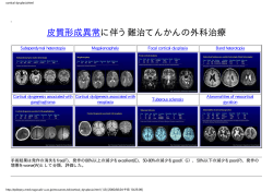 cortical dysplasiahtml