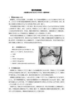 膝半月板損傷 a b * *