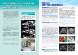開頭手術による脳腫瘍摘出術【 602KB】