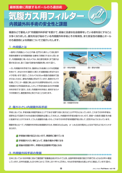 気腹ガス用フィルター