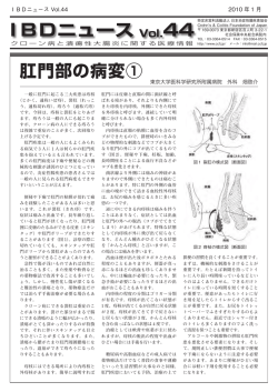 IBDニュースvol.44