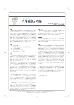 半月板部分切除